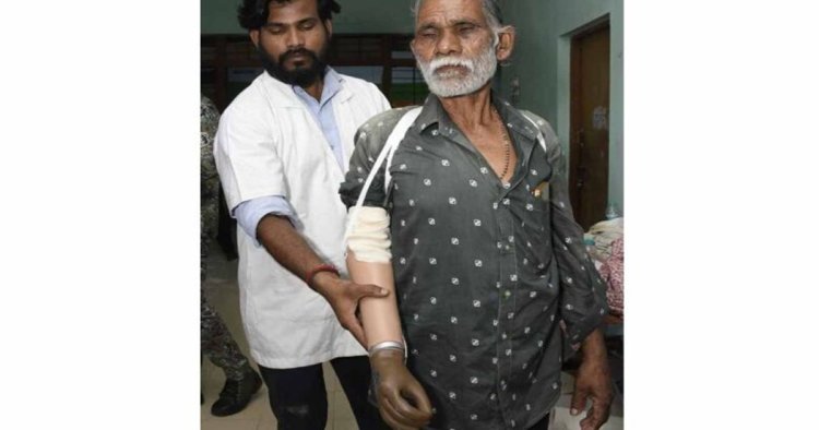 ट्रेन हादसे के दर्द पर ‘सेवा संकल्प’ का मरहम, धमतरी के तेजराम को दो घंटे में मिला कृत्रिम हाथ, लौटी जिंदगी की रंगत